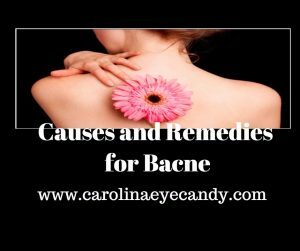 Causes and Remedies for Bacne