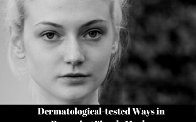 Dermatological-tested Ways in Removing Pimple Marks