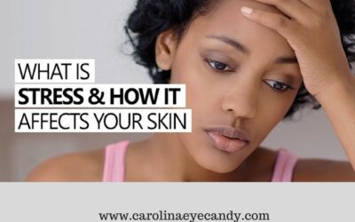 How To Avoid Skin Stress: Causes, Signs and Symptoms, & Beauty Tips