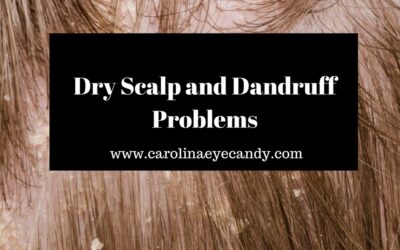 Dry Scalp And Dandruff Problems